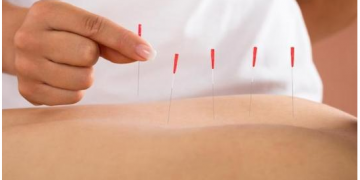 Les 5 bienfaits suite à une séance d’acupuncture
