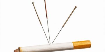 L’acupuncture aide t-elle à l’arrêt du tabac ?