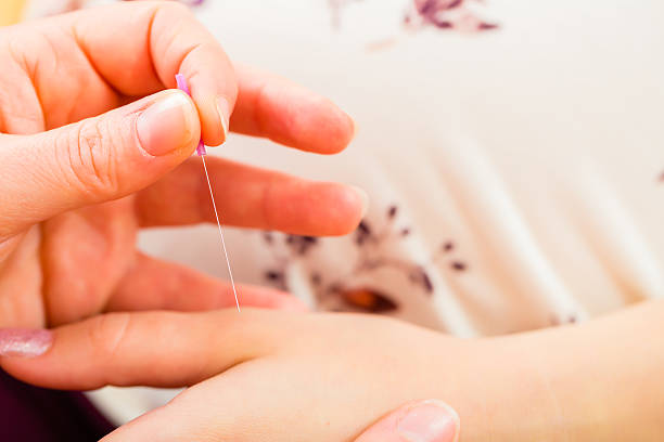 acupuncture comme outil de prévention