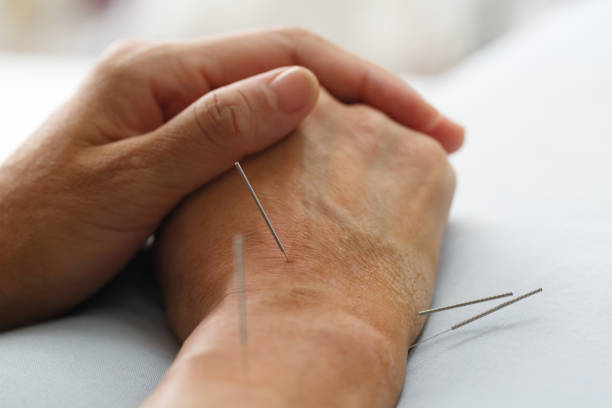 acupuncture permet de soulager l'arthrose au genou mains, hanche cervicales et colonne vertébrale