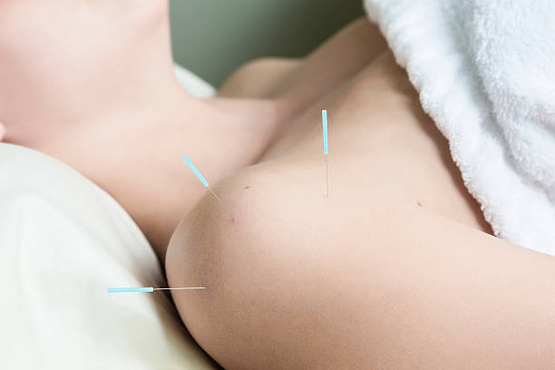 acupuncture efficace pour l'inflammation