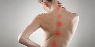 L&rsquo;Acupuncture : Une Approche Naturelle pour Soulager les Douleurs Chroniques