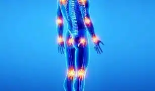 tendinite acupuncture